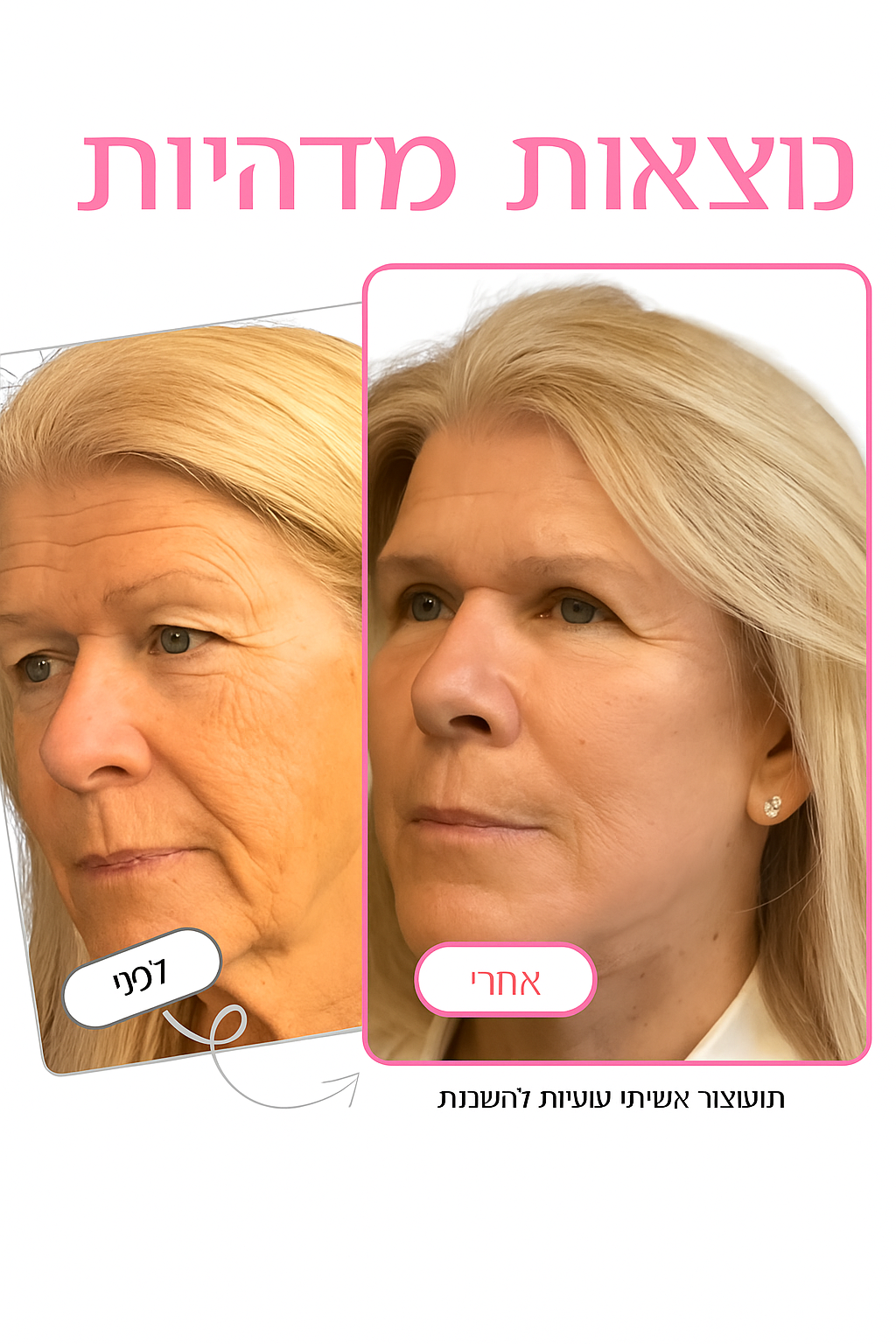 באלם דרמה־קלציום של Ayvanna