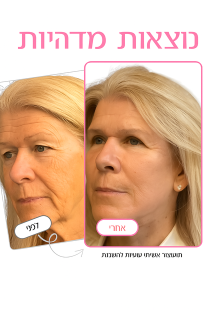 באלם דרמה־קלציום של Ayvanna