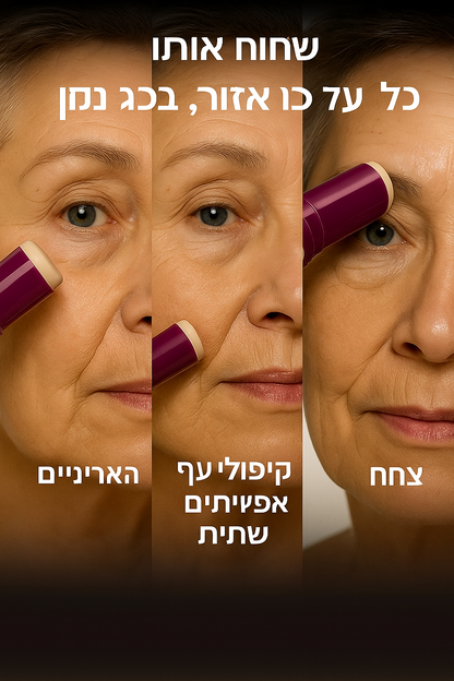 באלם דרמה־קלציום של Ayvanna